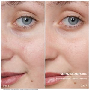 DOCTOR BABOR - Power Serum Ampoules - Ceramide